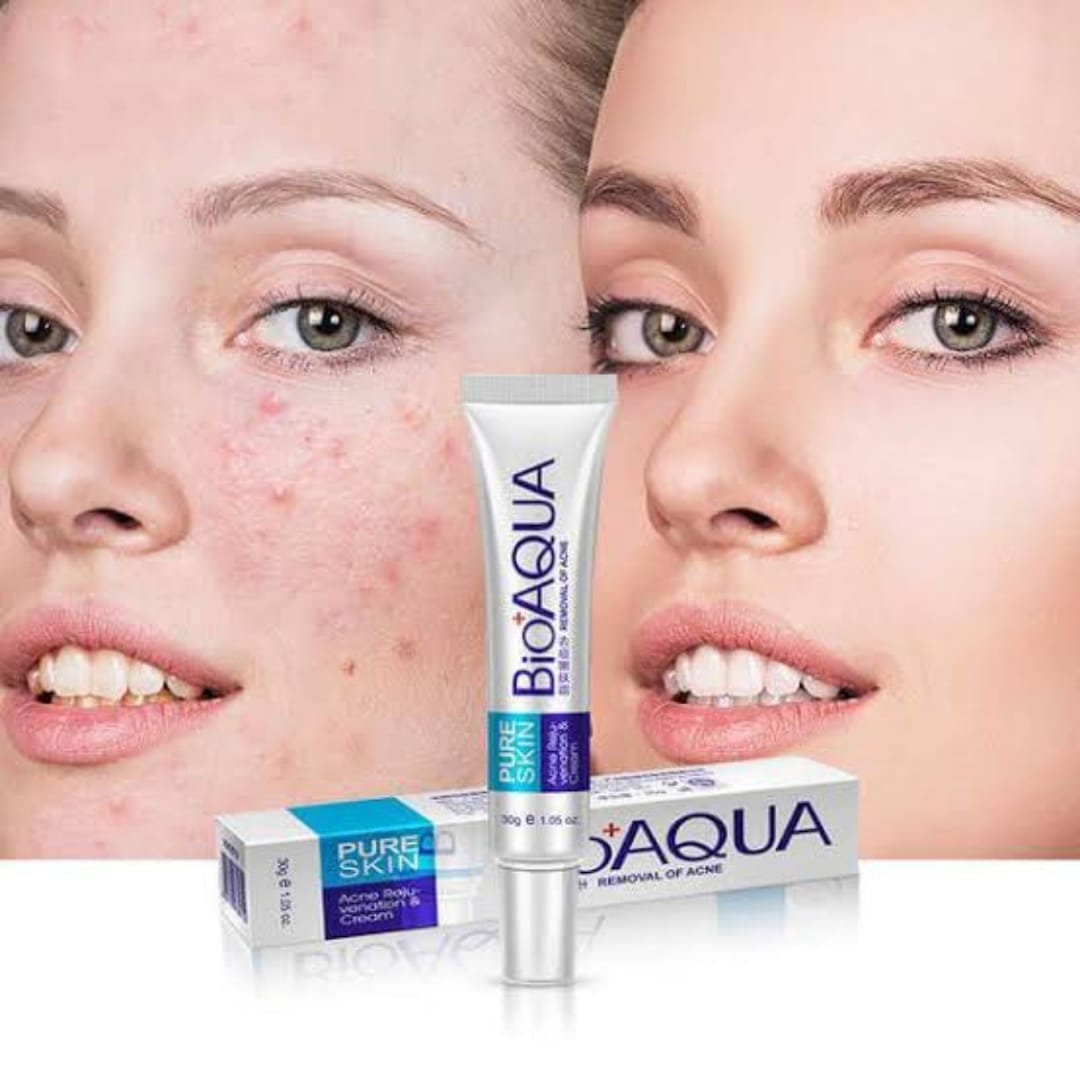 BIOAQUA Anti Acne Cream Acne Scar Removal Cream | Best Quality Scar Removal Cream 30g( Original )